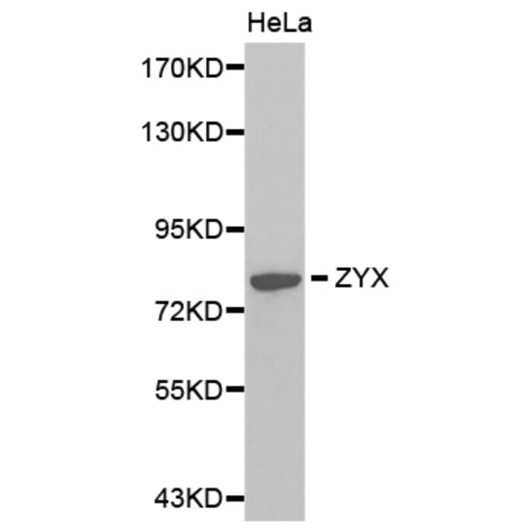 Western blot - ZYX antibody from Signalway Antibody (38377) - Antibodies.com