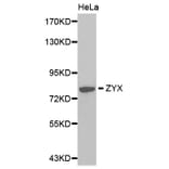 Western blot - ZYX antibody from Signalway Antibody (38377) - Antibodies.com