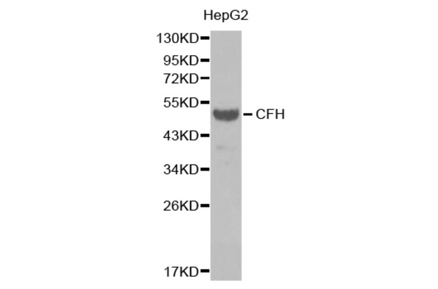 Western blot - CFH antibody from Signalway Antibody (38390) - Antibodies.com