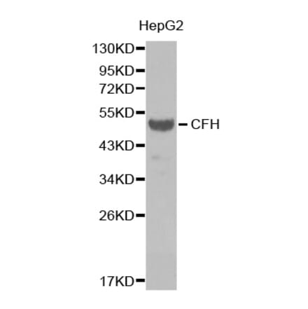Western blot - CFH antibody from Signalway Antibody (38390) - Antibodies.com