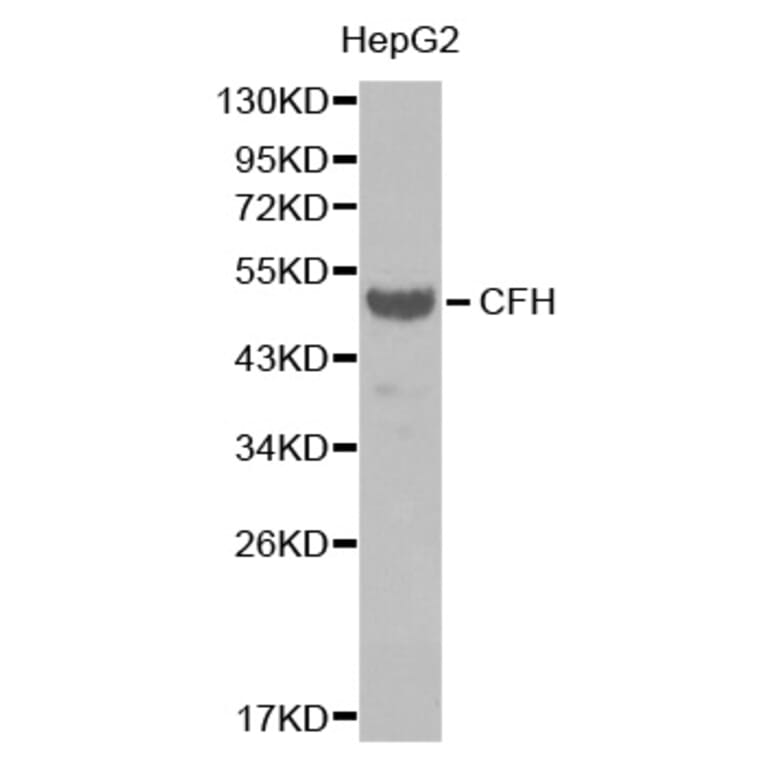 Western blot - CFH antibody from Signalway Antibody (38390) - Antibodies.com