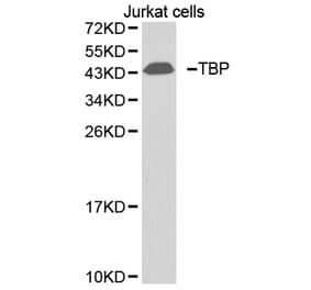 Western blot - TBP antibody from Signalway Antibody (38396) - Antibodies.com