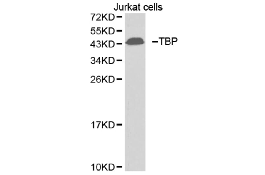 Western blot - TBP antibody from Signalway Antibody (38396) - Antibodies.com