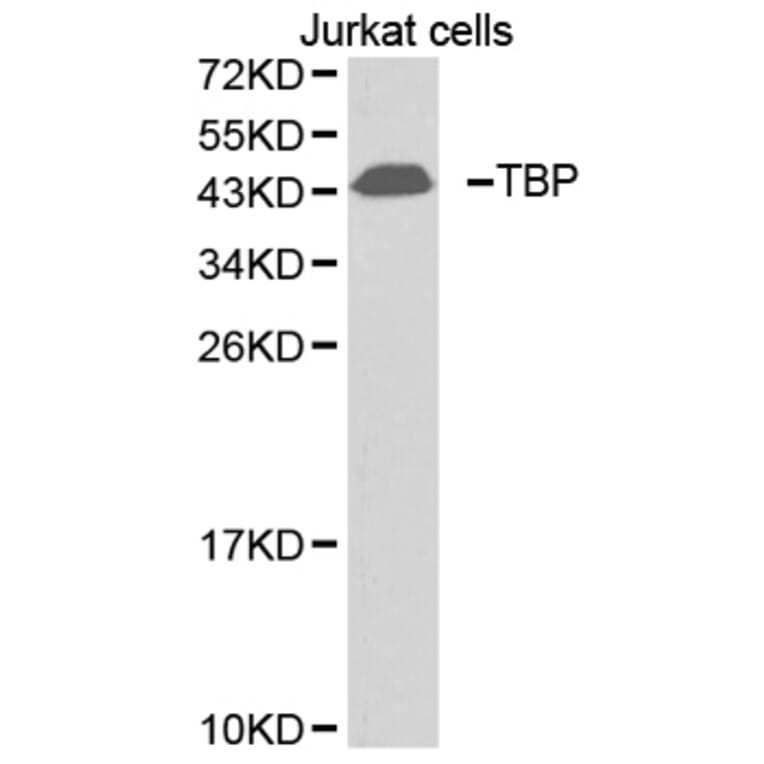 Western blot - TBP antibody from Signalway Antibody (38396) - Antibodies.com