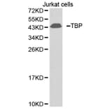 Western blot - TBP antibody from Signalway Antibody (38396) - Antibodies.com