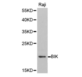 Western blot - BIK antibody from Signalway Antibody (38406) - Antibodies.com