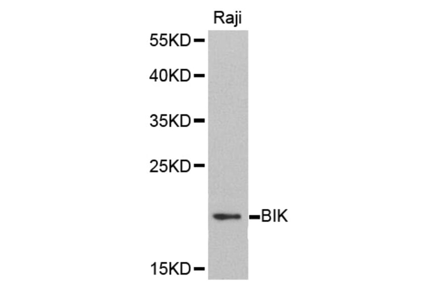 Western blot - BIK antibody from Signalway Antibody (38406) - Antibodies.com