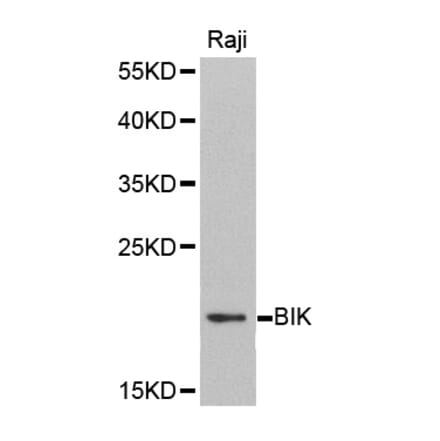 Western blot - BIK antibody from Signalway Antibody (38406) - Antibodies.com