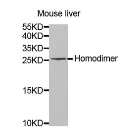 Western blot - IL8 antibody from Signalway Antibody (38419) - Antibodies.com
