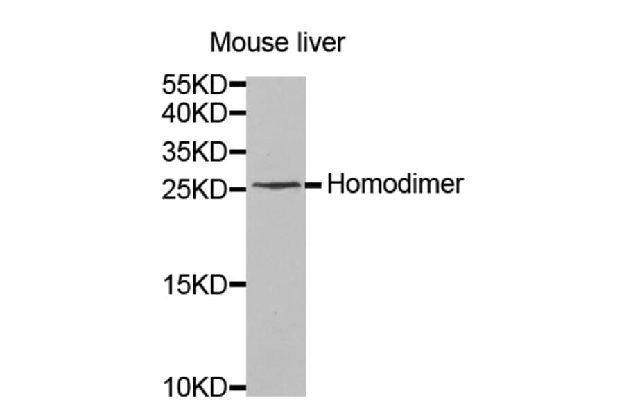 Western blot - IL8 antibody from Signalway Antibody (38419) - Antibodies.com