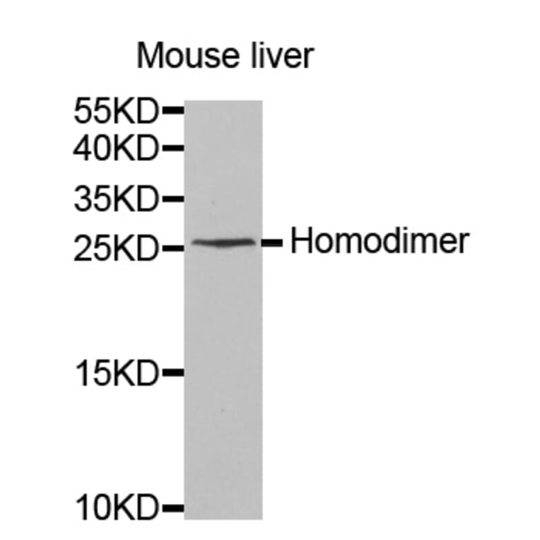 Western blot - IL8 antibody from Signalway Antibody (38419) - Antibodies.com