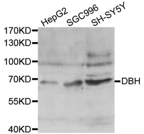 Western blot - DBH antibody from Signalway Antibody (38444) - Antibodies.com