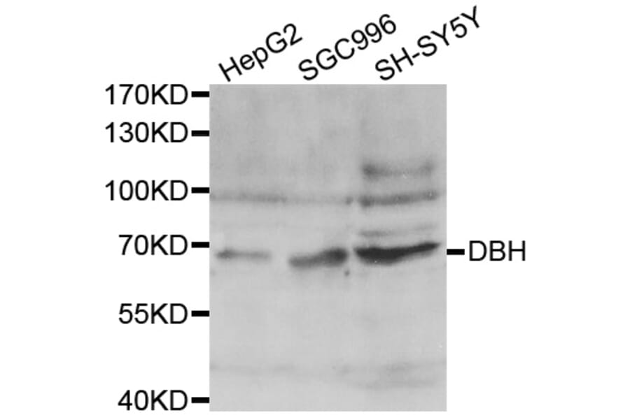Western blot - DBH antibody from Signalway Antibody (38444) - Antibodies.com