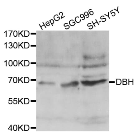 Western blot - DBH antibody from Signalway Antibody (38444) - Antibodies.com
