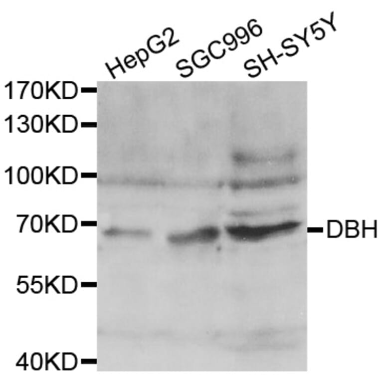 Western blot - DBH antibody from Signalway Antibody (38444) - Antibodies.com