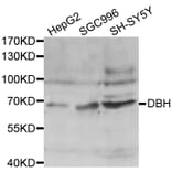 Western blot - DBH antibody from Signalway Antibody (38444) - Antibodies.com