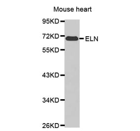 Western blot - ELN antibody from Signalway Antibody (38448) - Antibodies.com