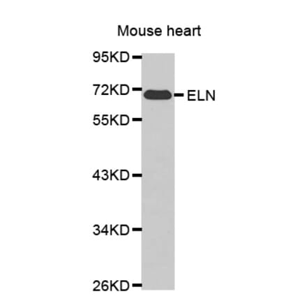 Western blot - ELN antibody from Signalway Antibody (38448) - Antibodies.com