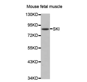 Western blot - SKI antibody from Signalway Antibody (38475) - Antibodies.com