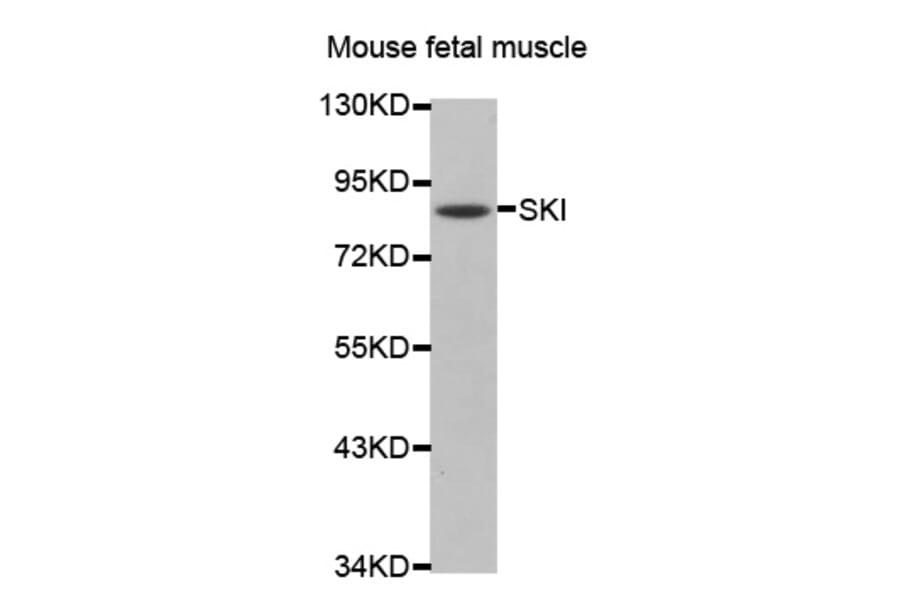 Western blot - SKI antibody from Signalway Antibody (38475) - Antibodies.com