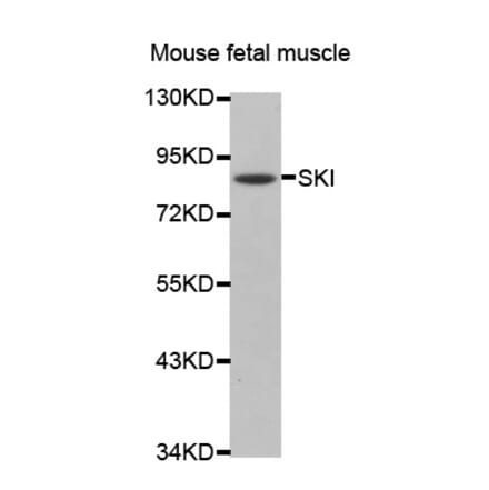 Western blot - SKI antibody from Signalway Antibody (38475) - Antibodies.com