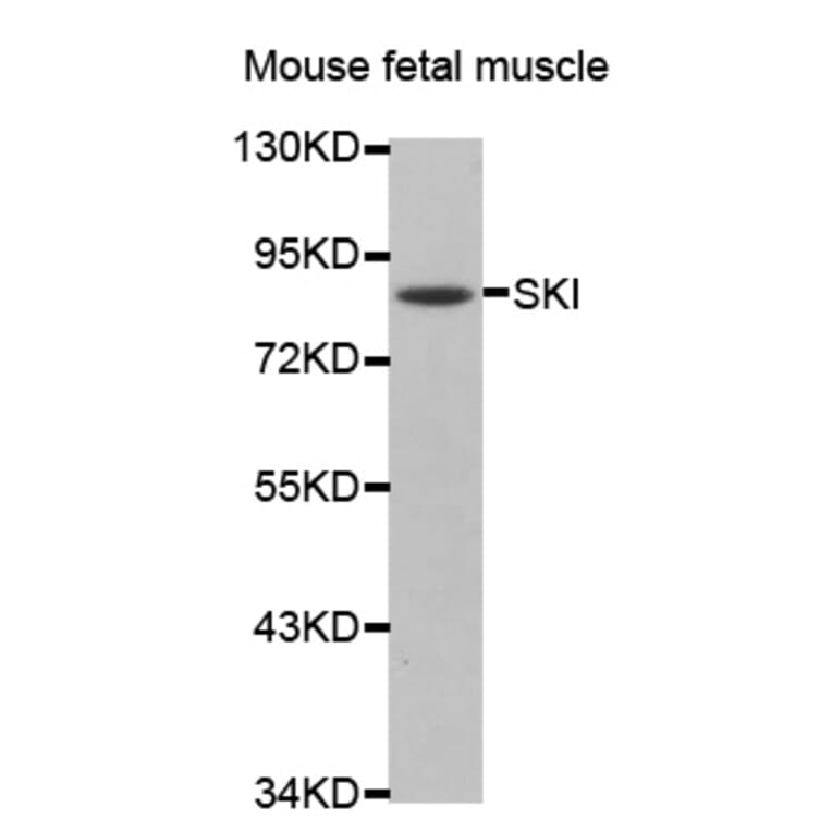 Western blot - SKI antibody from Signalway Antibody (38475) - Antibodies.com