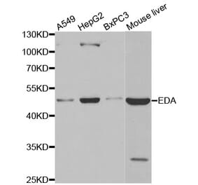 Western blot - EDA antibody from Signalway Antibody (38491) - Antibodies.com