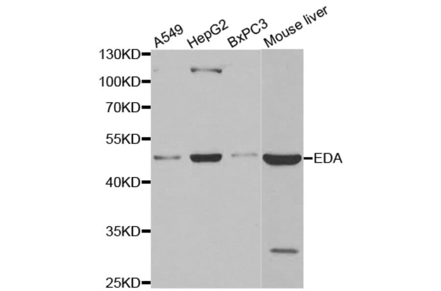 Western blot - EDA antibody from Signalway Antibody (38491) - Antibodies.com