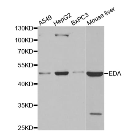 Western blot - EDA antibody from Signalway Antibody (38491) - Antibodies.com