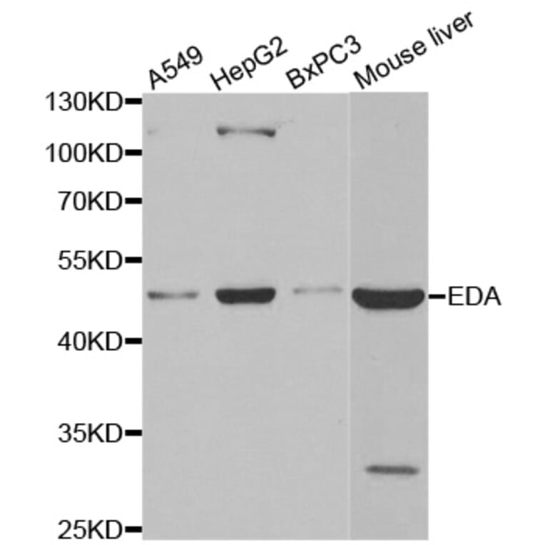 Western blot - EDA antibody from Signalway Antibody (38491) - Antibodies.com