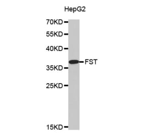 Western blot - FST antibody from Signalway Antibody (38500) - Antibodies.com