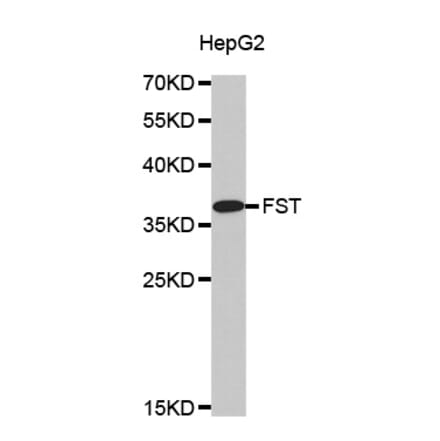 Western blot - FST antibody from Signalway Antibody (38500) - Antibodies.com