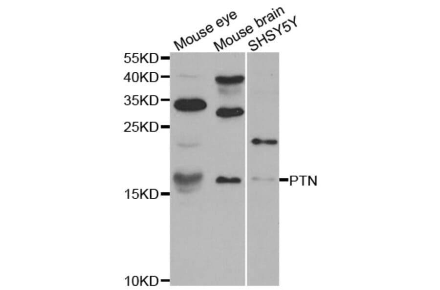 Western blot - PTN antibody from Signalway Antibody (38594) - Antibodies.com