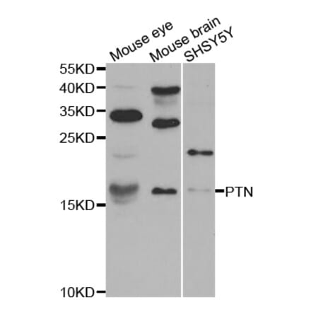 Western blot - PTN antibody from Signalway Antibody (38594) - Antibodies.com