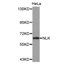 Western blot - NLK antibody from Signalway Antibody (38629) - Antibodies.com