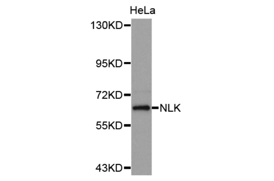 Western blot - NLK antibody from Signalway Antibody (38629) - Antibodies.com