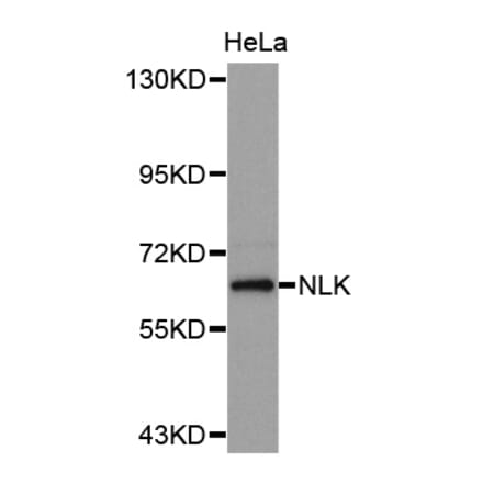 Western blot - NLK antibody from Signalway Antibody (38629) - Antibodies.com