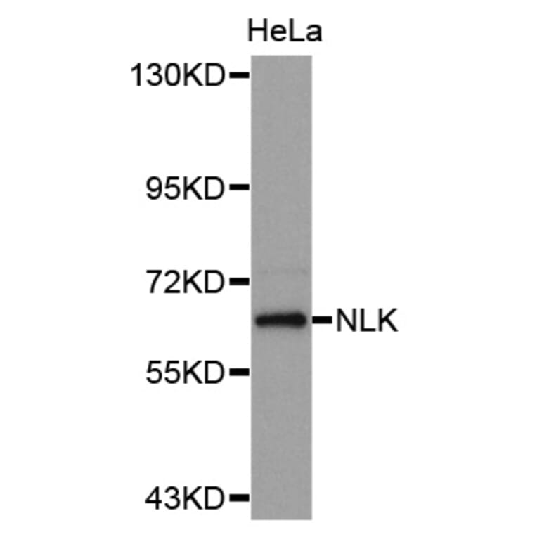 Western blot - NLK antibody from Signalway Antibody (38629) - Antibodies.com