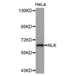 Western blot - NLK antibody from Signalway Antibody (38629) - Antibodies.com