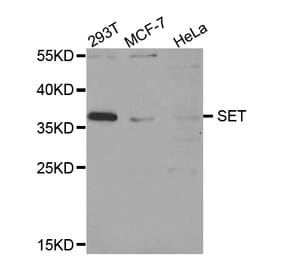 Western blot - SET antibody from Signalway Antibody (38752) - Antibodies.com