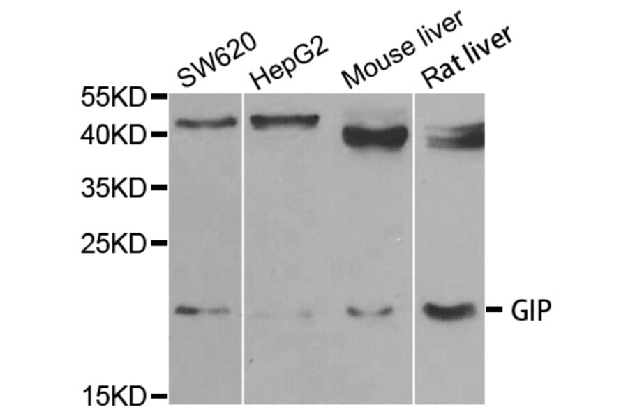Western blot - GIP antibody from Signalway Antibody (38763) - Antibodies.com