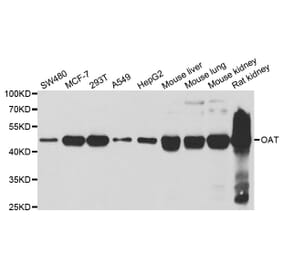 Western blot - OAT antibody from Signalway Antibody (38766) - Antibodies.com
