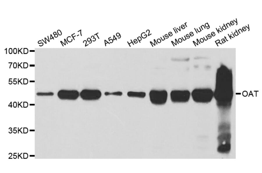 Western blot - OAT antibody from Signalway Antibody (38766) - Antibodies.com
