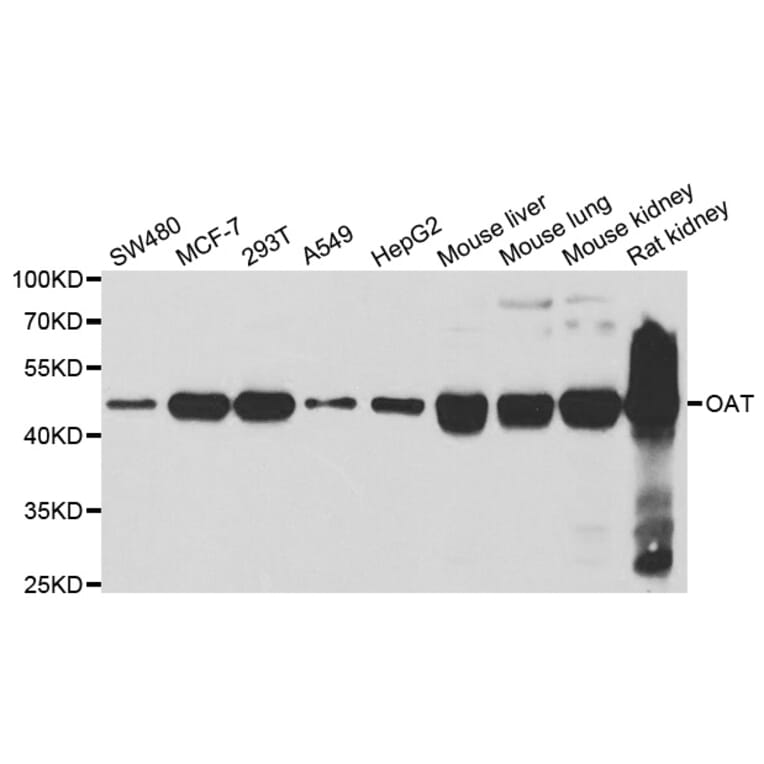 Western blot - OAT antibody from Signalway Antibody (38766) - Antibodies.com
