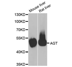 Western blot - AGT antibody from Signalway Antibody (38789) - Antibodies.com