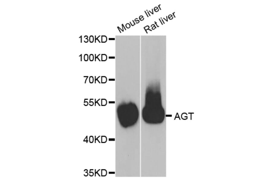 Western blot - AGT antibody from Signalway Antibody (38789) - Antibodies.com