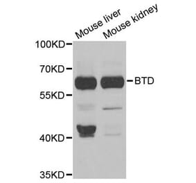 Western blot - BTD antibody from Signalway Antibody (38793) - Antibodies.com
