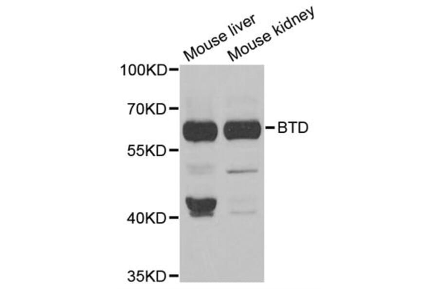 Western blot - BTD antibody from Signalway Antibody (38793) - Antibodies.com