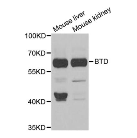 Western blot - BTD antibody from Signalway Antibody (38793) - Antibodies.com
