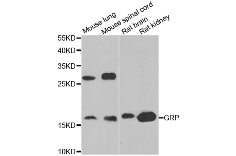 Western blot - GRP antibody from Signalway Antibody (38863) - Antibodies.com